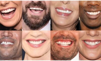 Celebrity Smiles, Lifestyle Results: How Social Media Inspires Reliable Teeth Whitening