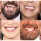 Celebrity Smiles, Lifestyle Results: How Social Media Inspires Reliable Teeth Whitening