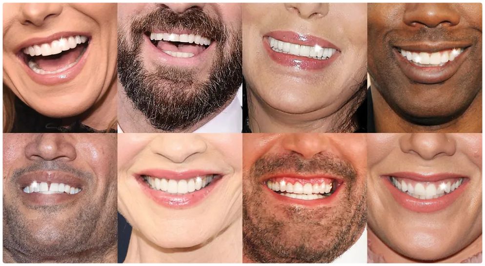 Celebrity Smiles, Lifestyle Results: How Social Media Inspires Reliable Teeth Whitening